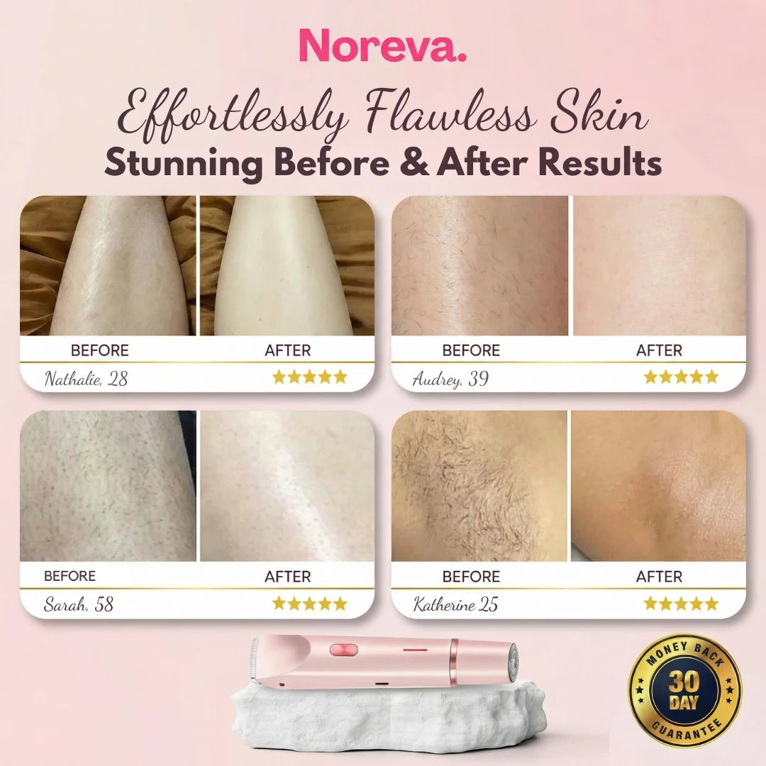Noreva Anti-Irritation Razor