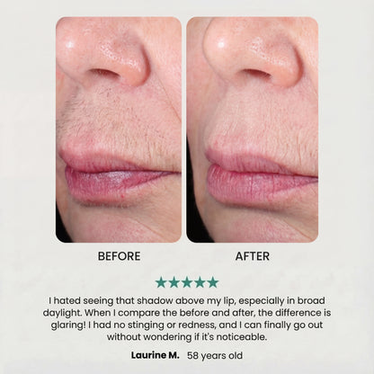 The Smooth Epilator Noreva