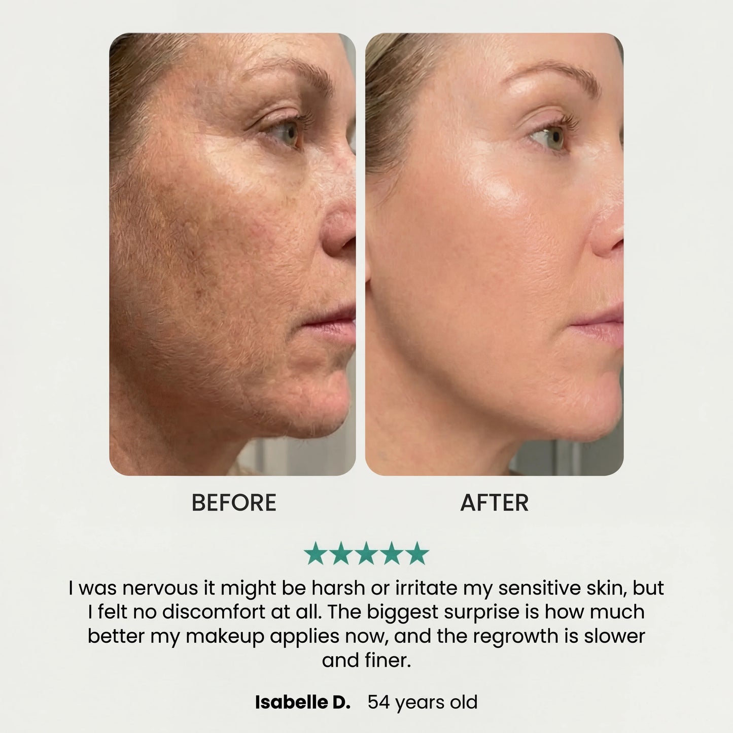 The Smooth Epilator Noreva