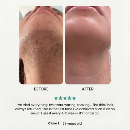 The Smooth Epilator Noreva