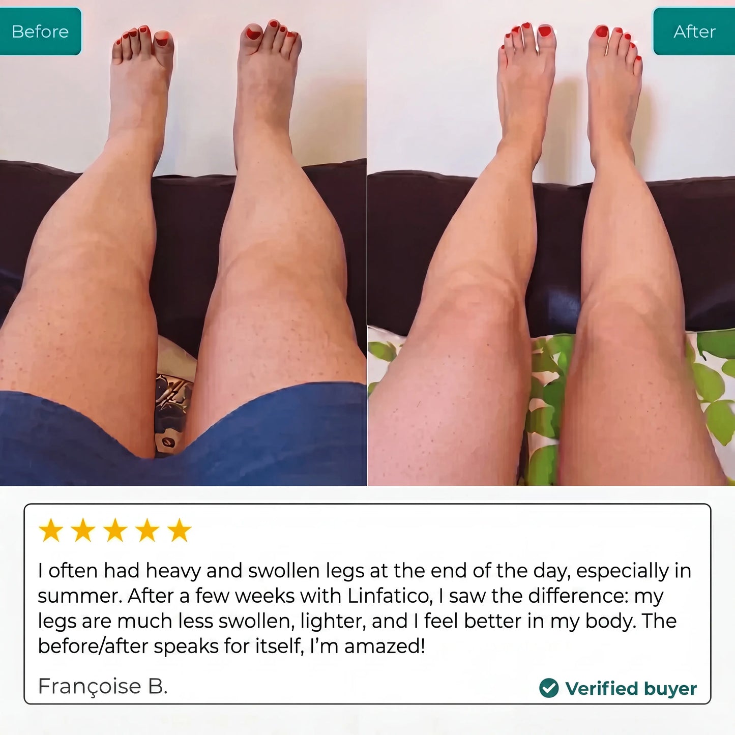 Lymphatic Drainage
