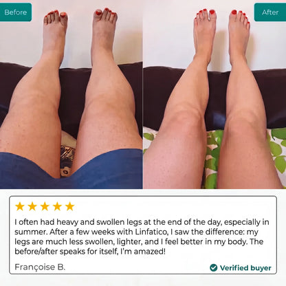Lymphatic Drainage