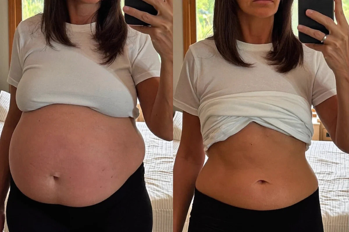 Alice T. before and after Noreva — 6 weeks