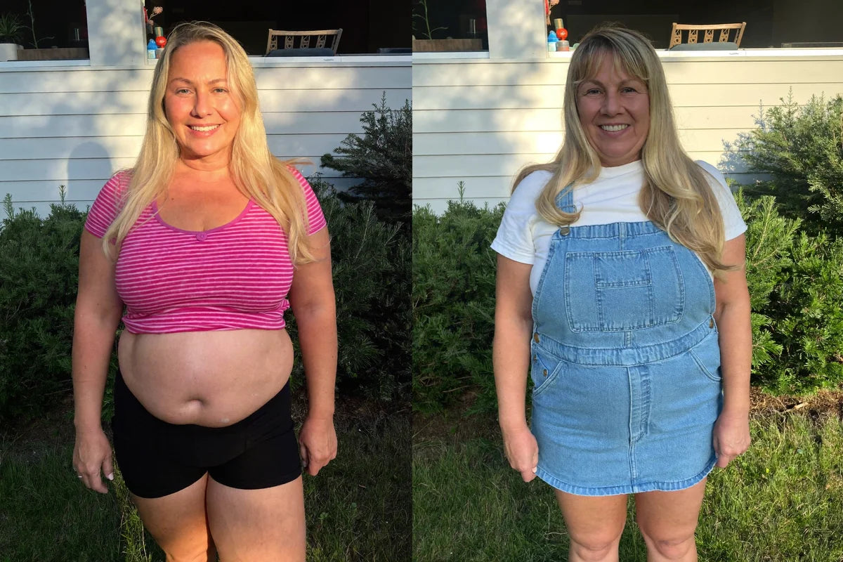 Barbara J. before and after Noreva — 6 weeks
