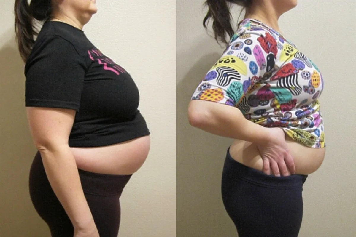 Debbie L. before and after Noreva — 5 weeks